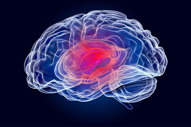 Neurological Trauma causes