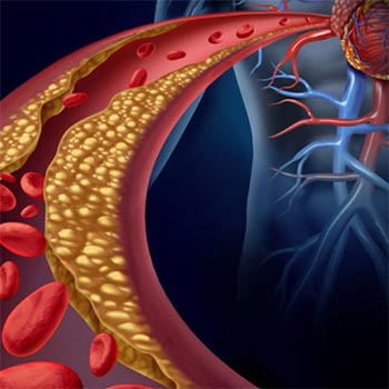 Evaluation and treatment of heart failure